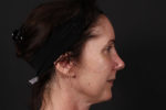 Necklift