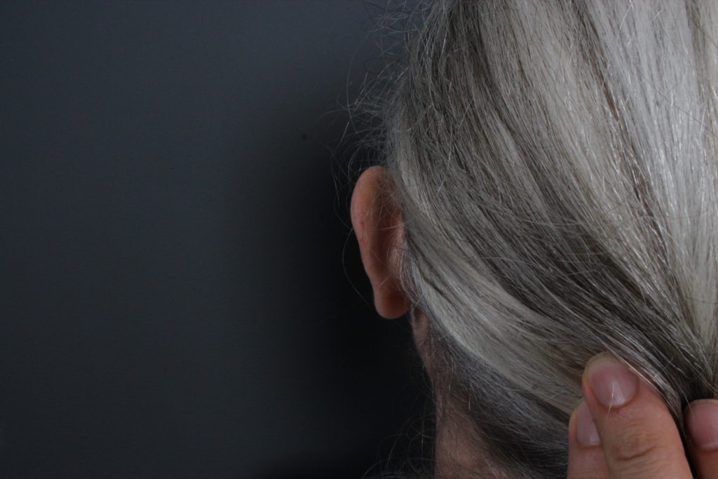 Ear Reduction/Otoplasty